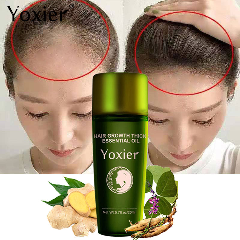 Effective Fast Growth Hair Care Serum Moisturizing  Anti-Hair Loss Scalp Repair Anti-Dry Anti-Breaking Ginger Scalp Treatment